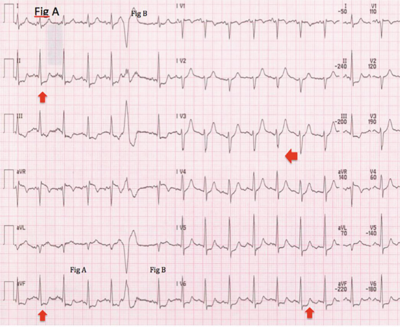 Fig. 9.4a