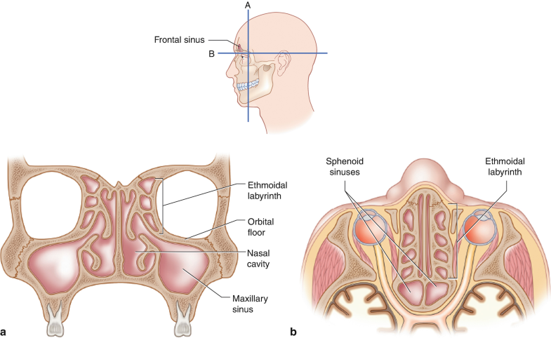 Sinonasal Cancer Springerlink