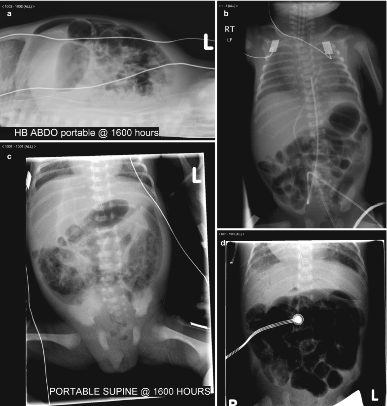 Abdomen Springerlink