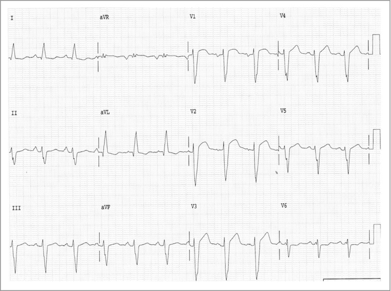 Electrocardiography Springerlink