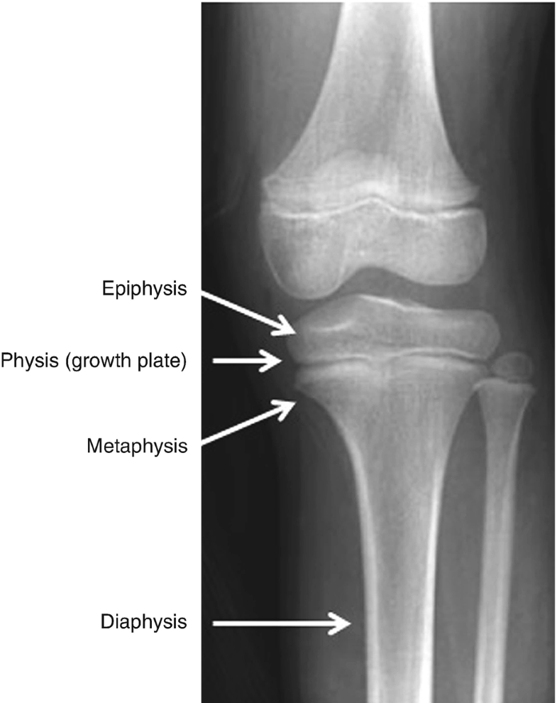 Introduction To Orthopedic Nomenclature Springerlink