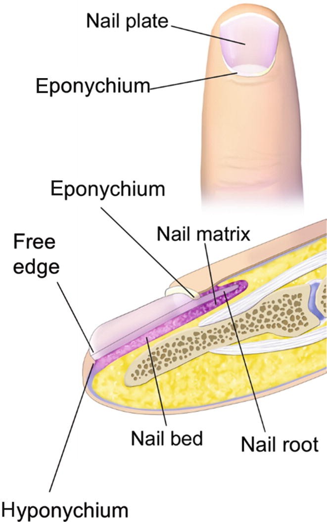 Fungal Nail Infections Springerlink