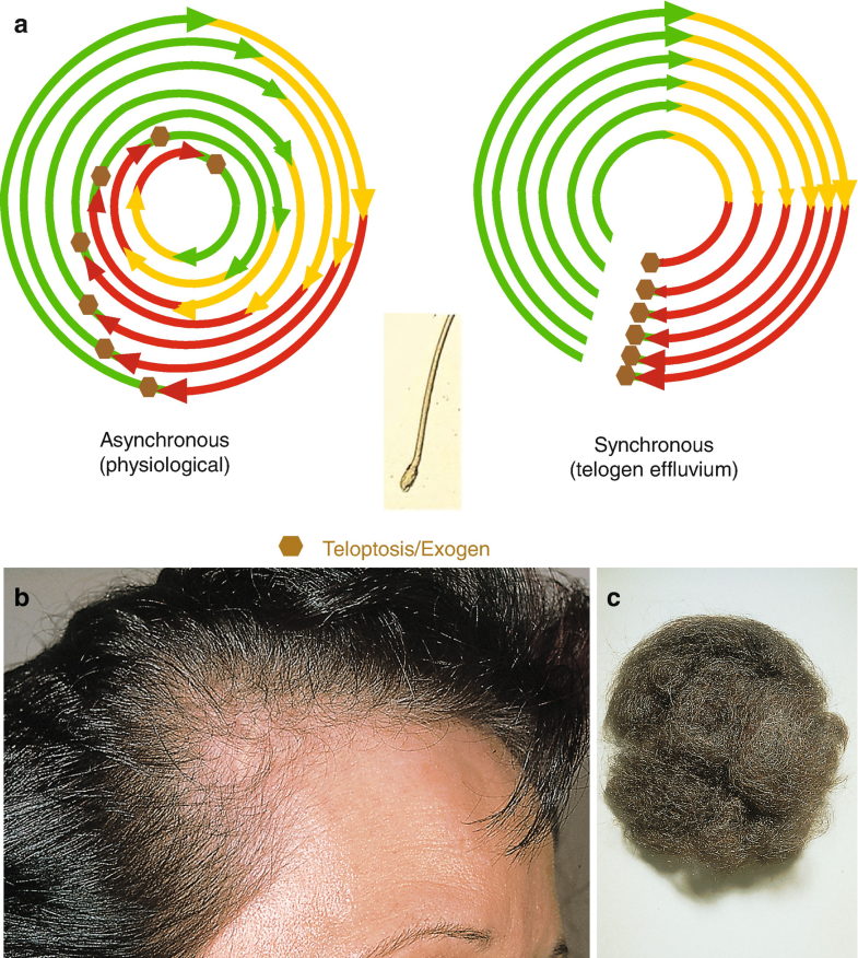 the hair cycle and its relation to