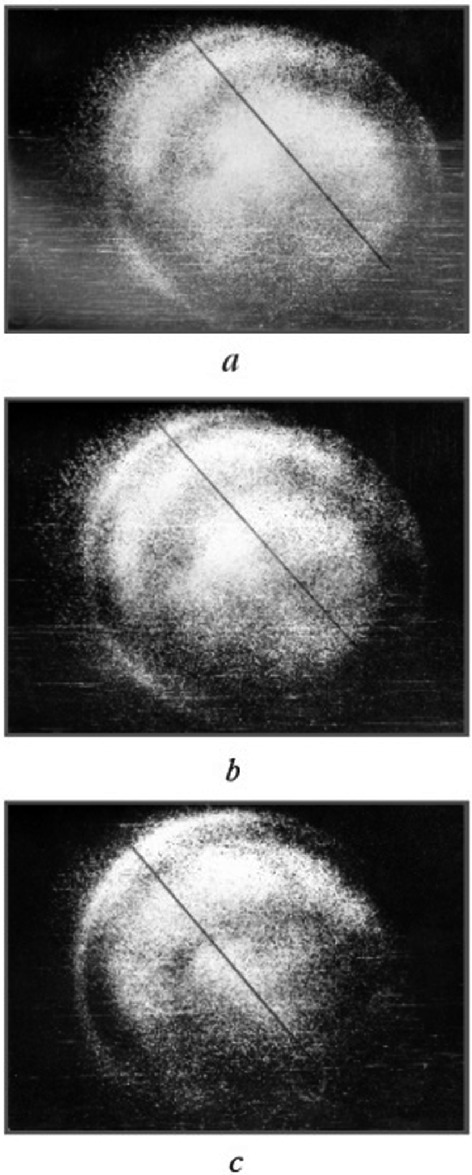 Holographic Interferometry For Studying Time Varying States Of The Human Surface Circulatory System Springerlink