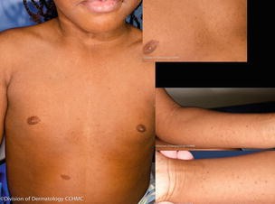 Cysts Springerlink