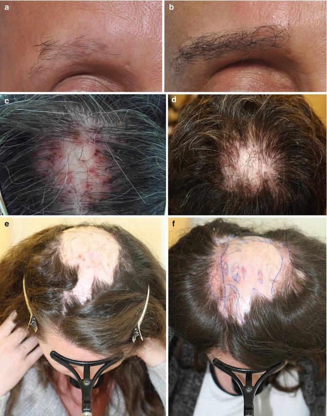 Plafond visa electron Plafond visa electron