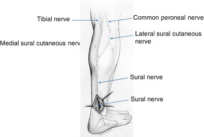 Normal Anatomy of the Peripheral (Sural) Nerve | SpringerLink