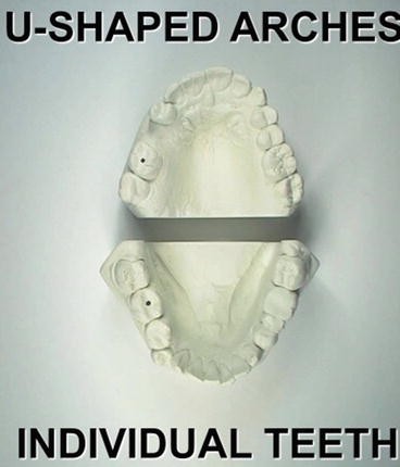 Forensic Odontology In Digital Era Springerlink - 