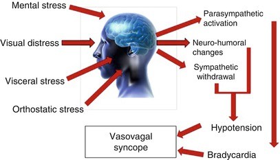 Role of the Autonomic Nervous System in Vasovagal Syncope | SpringerLink
