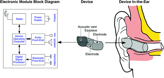 Ear-EEG: Continuous Brain Monitoring | SpringerLink