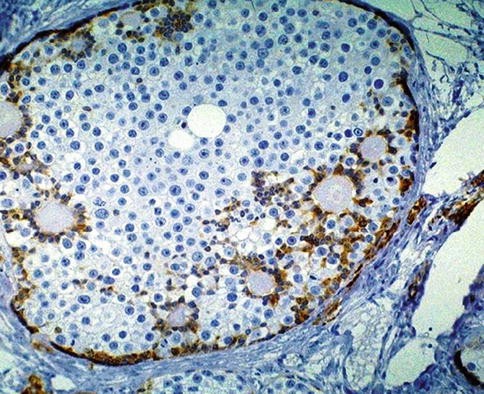 Testis And Paratesticular Structures Springerlink Testis And Paratesticular Structures Springerlink