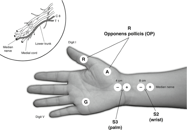 Elbow, Wrist, Palm Hand SpringerLink