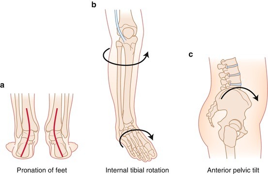 Posterior Float Normal Musculoskeletal Anatomic, Gait, and Balance Changes in Pregnancy and ...