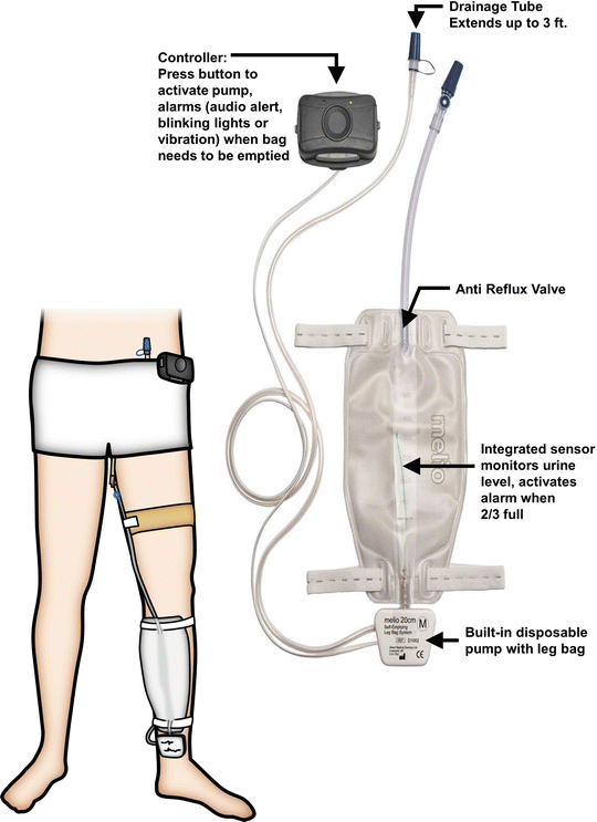 Urinary Drainage Bags SpringerLink