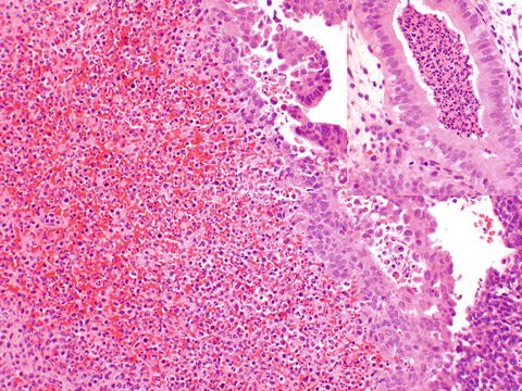 endometriumin dating histologia