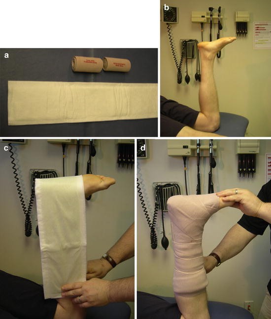 Soft Tissue Injuries SpringerLink