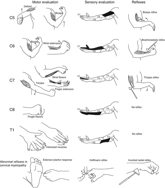 The Cervical Spine Springerlink