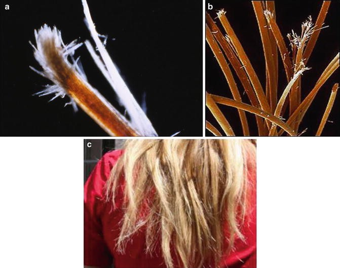 Understanding Hair Damage Springerlink