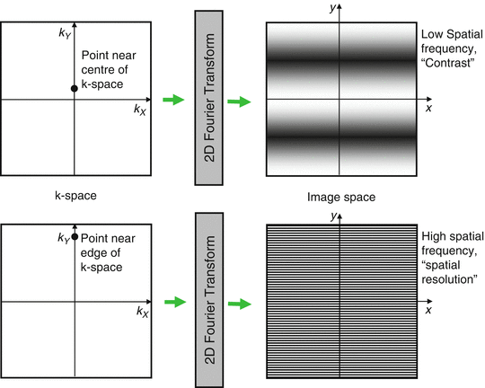 Image Space And K Space Springerlink Image Space And K Space Springerlink