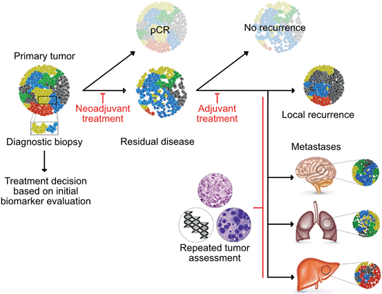 Intratumor Heterogeneity in Breast Cancer | SpringerLink