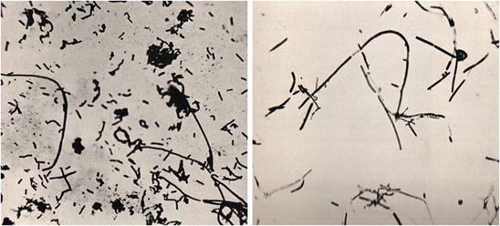 Probiotics in Dairy Products | SpringerLink