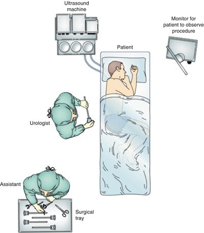 Transrectal Ultrasound of the Prostate | SpringerLink