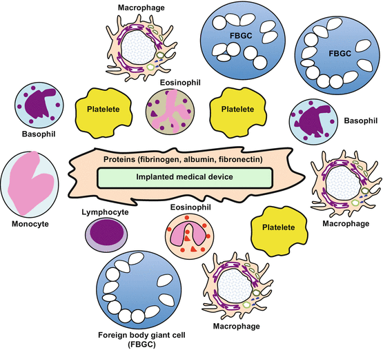 Biomaterials for Implants | SpringerLink