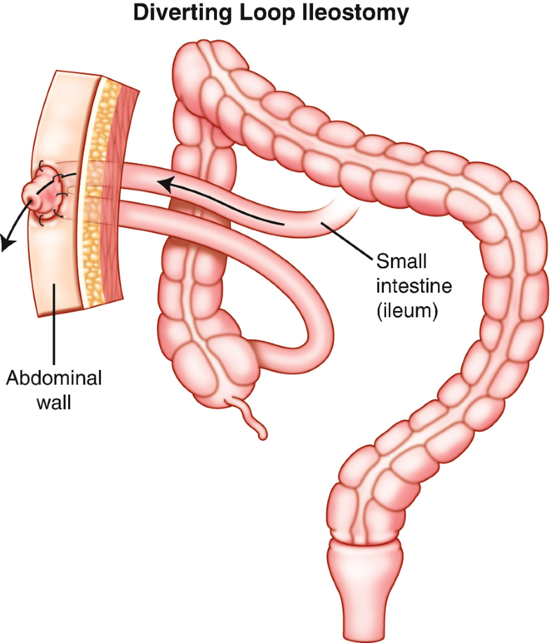 Anastomotic Construction | SpringerLink