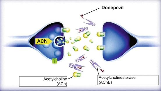 Donepezil Purchase