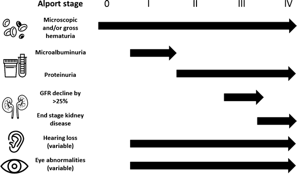 Alport Syndrome And Other Collagen Disorders Springerlink