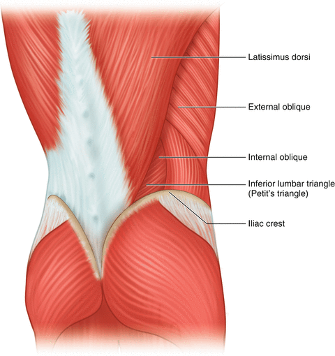 Laparoscopic Repair Of Flank Hernias Springerlink