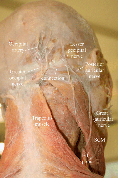 Great Auricular Posterior Auricular Nerve Entrapment Springerlink