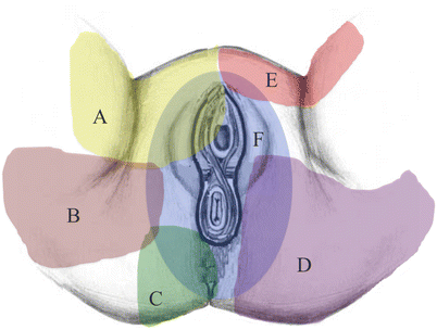 Ilioinguinal Nerve Entrapment: Pelvic | SpringerLink