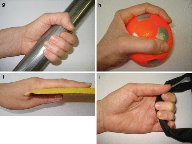 Clinical Assessment and Rehabilitation of the Upper Limb Following ...