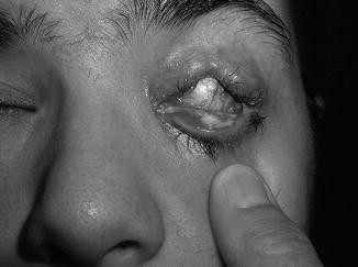 pszeudo-diagnosztika a szemészetben