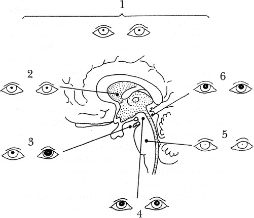 How should you position an unconscious patient who is paralyzed on the right side