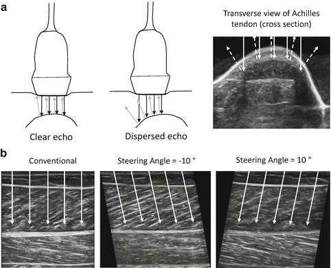 Ultrasound Technology For Examining The Mechanics Of The Muscle Tendon And Ligament Springerlink
