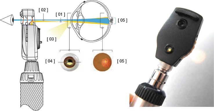 Optics In Medicine Springerlink