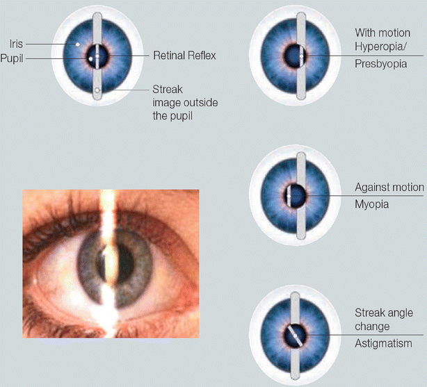 Optics In Medicine Springerlink