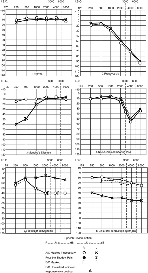 Image Result For Cochlear Frequency Image Result For Cochlear Frequency