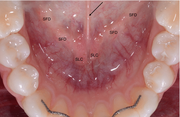 Floor Of Mouth Springerlink