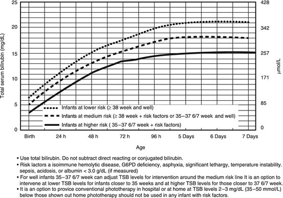 Jaundice Level Chart For Newborns Singapore