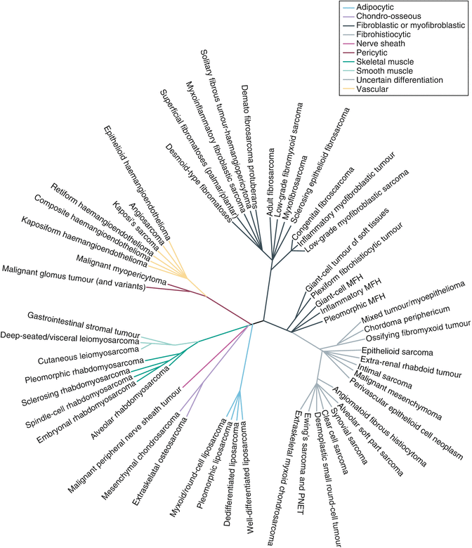 The Non Rhabdomyosarcoma Soft Tissue Sarcomas Desmoid Tumor And