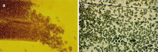 pinworm scatology széles szalagféreg kezelésére szolgáló gyógyszerek