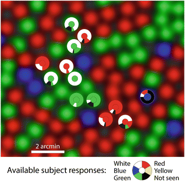 Functional Imaging Of Cone Photoreceptors Springerlink