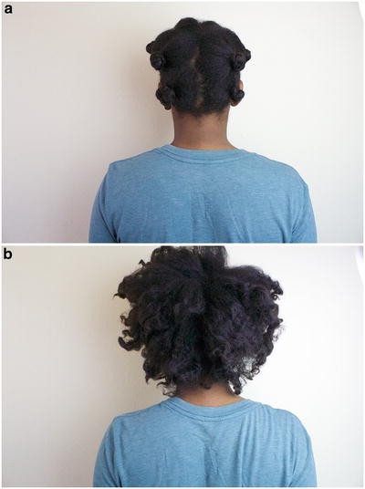 Developing A Healthy Hair Regimen Ii Transitioning To Chemical Free Styling To Natural Hair And Prevention Of Hair Trauma Springerlink
