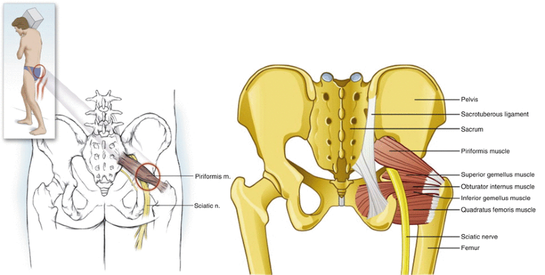 Массаж грушевидной мышцы в картинках