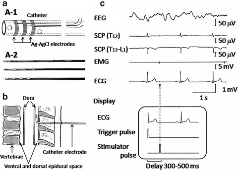 Monitoring Of Spinal Cord Functions Springerlink