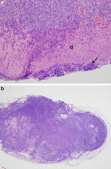Pathology Evaluation For Detection Of Immunomodulation Springerlink Open Image In New Window