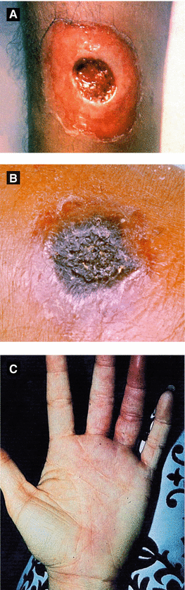 Infectious Diseases Springerlink